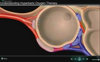 How Hyperbaric Oxygen Therapy Works