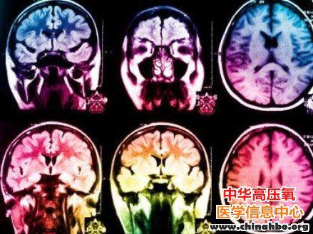 脑细胞不能再生？——Science：科学家破解中风后大脑生成新神经细胞的机制