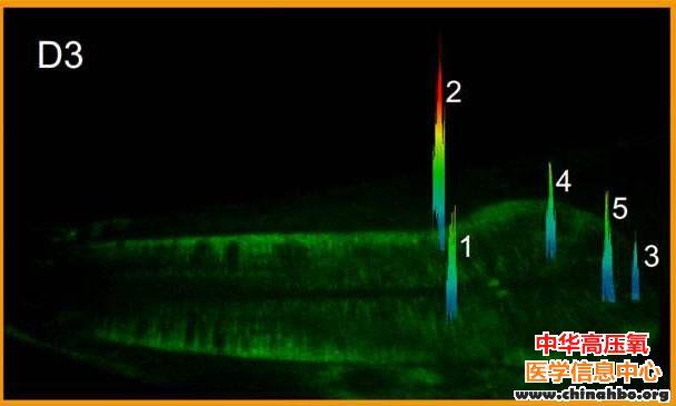 中国学者在nature发文——发现线粒体“超氧炫”可预测寿命