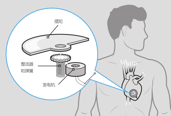 还真有！——无需电池的 自动心脏起搏器