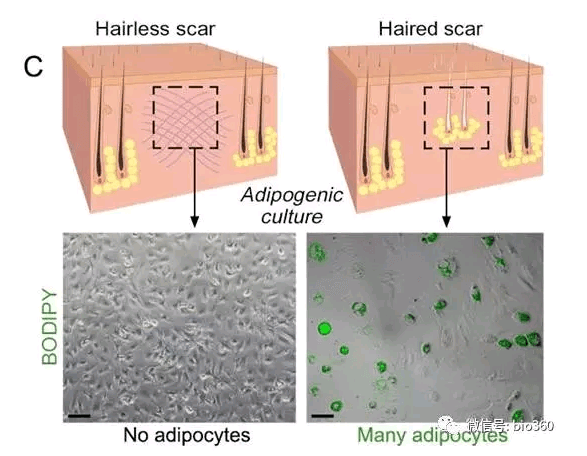 Science：想要伤口不留疤，脂肪细胞不可少