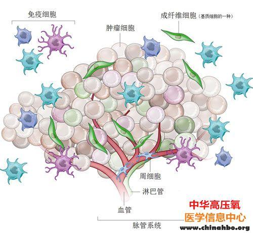 科学家发现肿瘤微环境促进肿瘤生长的“秘密”