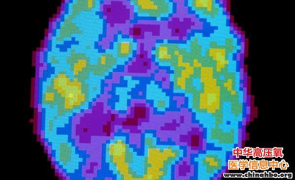 Science：人为什么需要睡眠？为了遗忘？