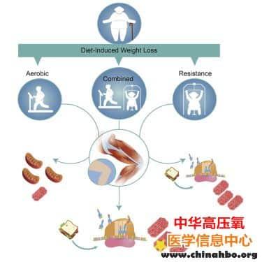 有氧运动和阻力训练保持肥胖老年人的肌肉质量