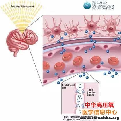 首次打开血脑屏障几个小时