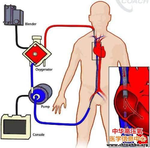 《PNAS》新技术通过静脉向血液直接打氧！